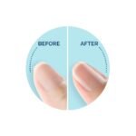 Scholl nail care set with images of before and after nail transformation